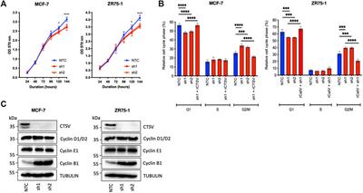 Cathepsin V regulates cell cycle progression and histone stability in the nucleus of breast cancer cells